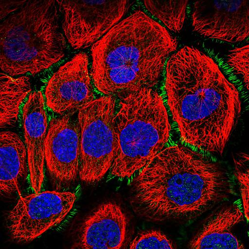  NCBI Organism:Homo sapiens; Cell Components:plasma membrane, nucleus, microtubule cytoskeleton; Biological process:organelle organization, cytoskeleton organization;