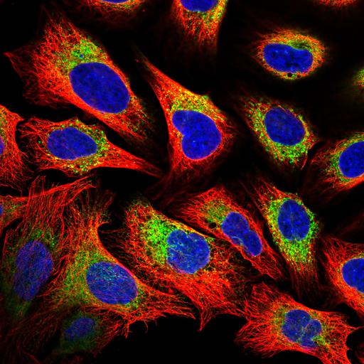  NCBI Organism:Homo sapiens; Cell Components:endoplasmic reticulum, nucleus, microtubule cytoskeleton; Biological process:organelle organization, cytoskeleton organization;