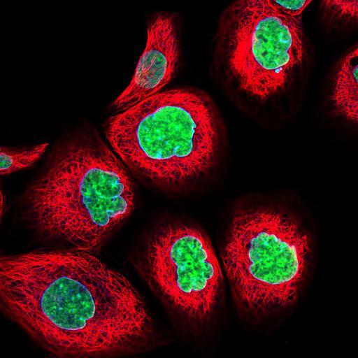  NCBI Organism:Homo sapiens; Cell Components:nucleus, nuclear membrane, microtubule cytoskeleton; Biological process:organelle organization, cytoskeleton organization;