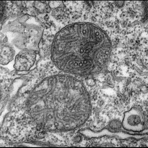  NCBI Organism:Paramecium multimicronucleatum; Cell Types:cell by organism, eukaryotic cell, , ; Cell Components:mitochondrion, mitochondrial membrane;