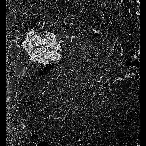  NCBI Organism:Paramecium multimicronucleatum; Cell Types:cell by organism, eukaryotic cell, , ; Cell Components:oral apparatus, early endosome membrane, microtubule associated complex, food vacuole; Biological process:oral apparatus organization, endosome organization;