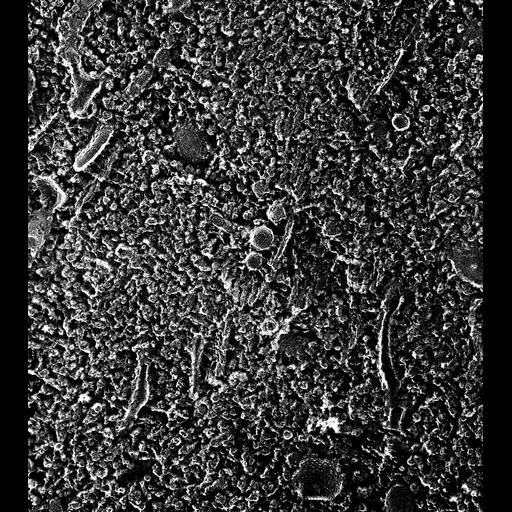  NCBI Organism:Paramecium multimicronucleatum; Cell Types:cell by organism, eukaryotic cell, , ; Cell Components:transport vesicle, microtubule associated complex, cytoplasmic dynein complex; Biological process:cytoplasmic microtubule organization, vesicle docking involved in exocytosis;