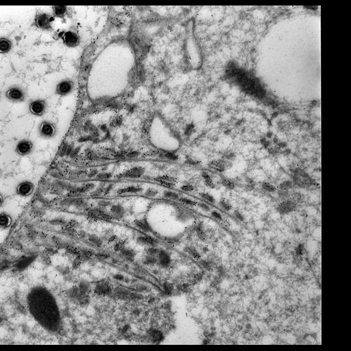  NCBI Organism:Paramecium multimicronucleatum; Cell Types:cell by organism, eukaryotic cell, , ; Cell Components:early phagosome, food vacuole, vesicle membrane; Biological process:digestive system process