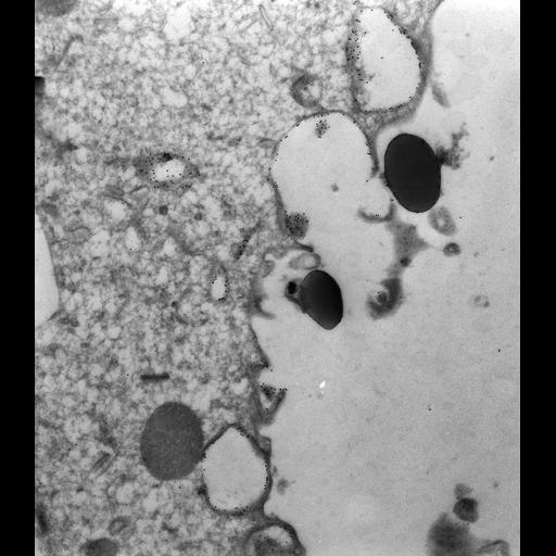  NCBI Organism:Paramecium multimicronucleatum; Cell Types:cell by organism, eukaryotic cell, , ; Cell Components:food vacuole, early phagosome; Biological process:digestive system process