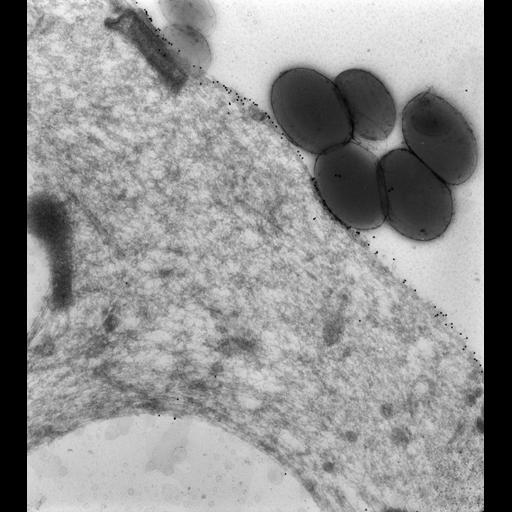  NCBI Organism:Paramecium multimicronucleatum; Cell Types:cell by organism, eukaryotic cell, , ; Cell Components:early phagosome, lysosome, vesicle membrane; Biological process:digestive system process