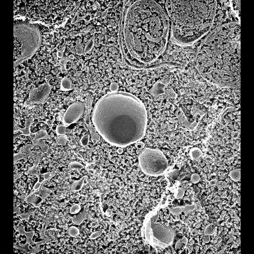  NCBI Organism:Paramecium multimicronucleatum; Cell Types:cell by organism, eukaryotic cell, , ; Cell Components:early phagosome, vesicle membrane, phagolysosome; Biological process:digestive system process