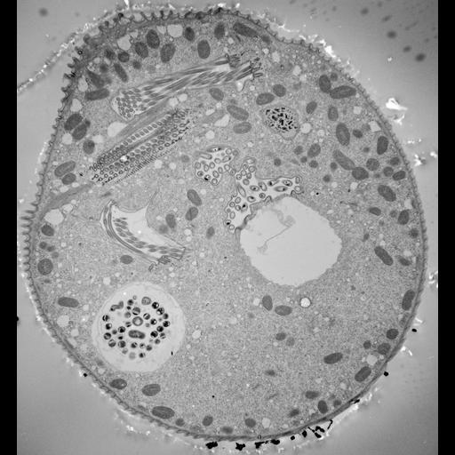  NCBI Organism:Vorticella convallaria; Cell Types:cell by organism, eukaryotic cell, , ; Cell Components:cell, food vacuole, micronucleus, contractile vacuole, contractile vacuole pore, oral apparatus, food vacuole; Biological process:digestive system process, cytoplasm organization, cortical cytoskeleton organization, micronucleus organization, contractile vacuole organization, oral apparatus organization, digestive system process;