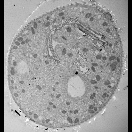  NCBI Organism:Vorticella convallaria; Cell Types:cell by organism, eukaryotic cell, , ; Cell Components:cell, food vacuole, contractile vacuole, oral apparatus; Biological process:digestive system process, cytoplasm organization, cortical cytoskeleton organization, oral apparatus organization, contractile vacuole organization;