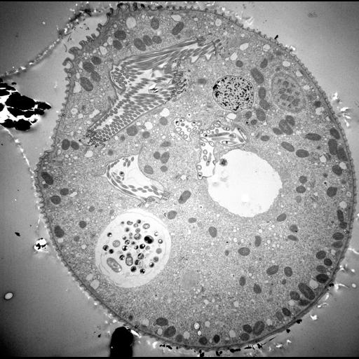  NCBI Organism:Vorticella convallaria; Cell Types:cell by organism, eukaryotic cell, , ; Cell Components:cell, food vacuole, macronucleus, micronucleus, contractile vacuole, contractile vacuole pore, oral apparatus; Biological process:digestive system process, cytoplasm organization, cortical cytoskeleton organization, macronucleus organization, micronucleus organization, contractile vacuole organization, oral apparatus organization;