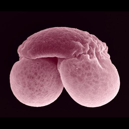  NCBI Organism:Pinus [NCBITaxon:139271]; Cell Components:pollen coat