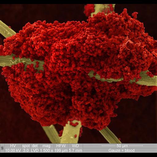  Cell Types:erythrocyte Cell Components:cell surface Biological process:blood coagulation