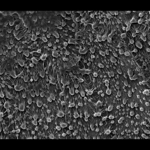 NCBI Organism:Utricularia aurea; Cell Components:cell surface