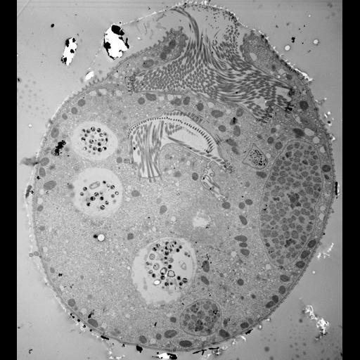  NCBI Organism:Vorticella convallaria; Cell Types:cell by organism, eukaryotic cell, , ; Cell Components:cell, food vacuole, macronucleus, micronucleus, oral apparatus, contractile vacuole; Biological process:digestive system process, cytoplasm organization, cortical cytoskeleton organization, contractile vacuole organization, macronucleus organization, , oral apparatus organization;