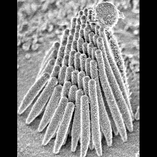  NCBI Organism:Rana catesbeiana; Cell Types:auditory hair cell Cell Components:cell surface Biological process:detection of mechanical stimulus involved in sensory perception of sound, sensory perception of sound;