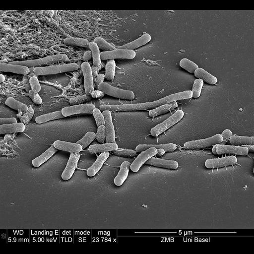  Cell Components:cell surface Biological process:response to bacterium, detection of bacterium;