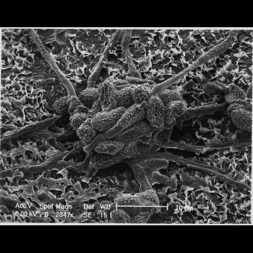  NCBI Organism:Botryotinia sphaerosperma; Cell Types:epithelial cell, fungal spore;