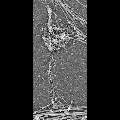  NCBI Organism:Rattus; Cell Types:hippocampal neuron Cell Components:dendritic spine, dendritic shaft, , actin cytoskeleton, microtubule cytoskeleton, intermediate filament cytoskeleton; Biological process:dendritic spine organization, dendrite morphogenesis;