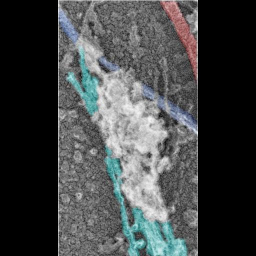  NCBI Organism:Rattus; Cell Types:hippocampal neuron Cell Components:dendritic spine, dendritic shaft, actin cytoskeleton, , microtubule, intermediate filament; Biological process:dendritic spine organization, dendrite morphogenesis;