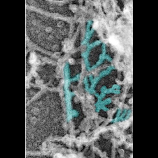  NCBI Organism:Rattus; Cell Types:hippocampal neuron Cell Components:dendritic spine, dendritic shaft, actin cytoskeleton; Biological process:dendritic spine organization, dendrite morphogenesis;