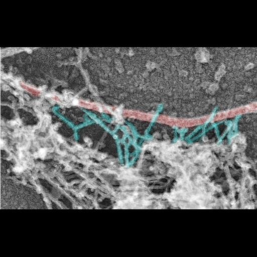  NCBI Organism:Rattus; Cell Types:hippocampal neuron Cell Components:dendritic spine, dendritic shaft, actin cytoskeleton, microtubule cytoskeleton; Biological process:dendritic spine organization, dendrite morphogenesis;