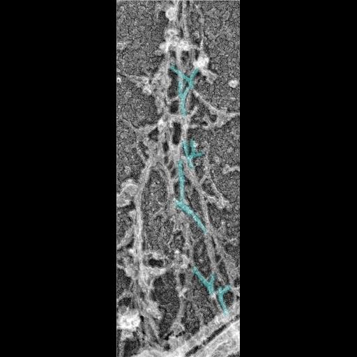  NCBI Organism:Rattus; Cell Types:hippocampal neuron Cell Components:dendritic spine, dendritic shaft, actin cytoskeleton; Biological process:dendritic spine organization, dendrite morphogenesis;