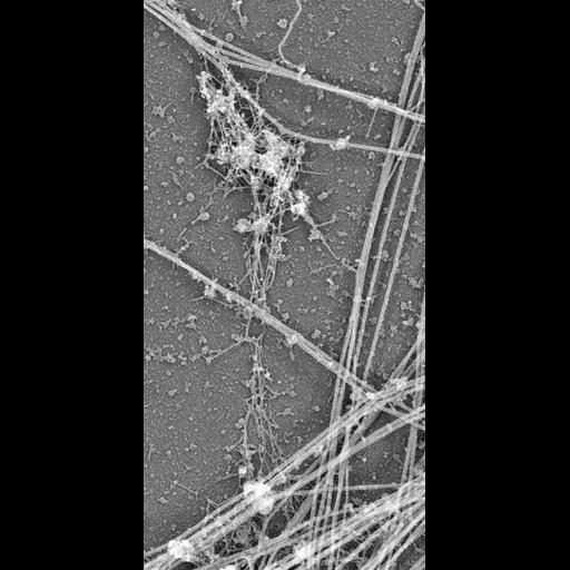  NCBI Organism:Rattus; Cell Types:hippocampal neuron Cell Components:dendritic spine, dendritic shaft, actin cytoskeleton, microtubule cytoskeleton; Biological process:dendritic spine organization, dendrite morphogenesis;