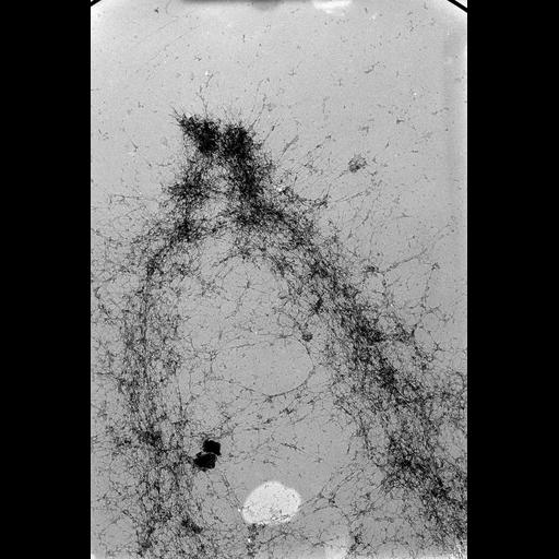  NCBI Organism:Mus musculus; Cell Types:fibroblast Cell Components:nuclear chromosome Biological process:chromosome organization, mitosis, mitotic metaphase;