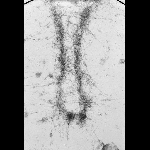  NCBI Organism:Mus musculus; Cell Types:fibroblast Cell Components:nuclear chromosome Biological process:chromosome organization, mitosis, mitotic metaphase;