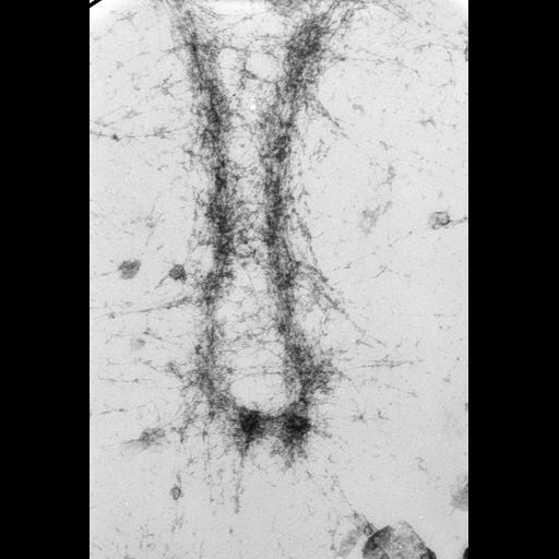  NCBI Organism:Mus musculus; Cell Types:fibroblast Cell Components:nuclear chromosome Biological process:chromosome organization, mitosis, mitotic metaphase;