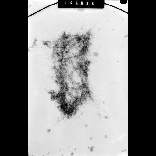  NCBI Organism:Mus musculus; Cell Types:fibroblast Cell Components:nuclear chromosome Biological process:chromosome organization, mitosis, mitotic metaphase;