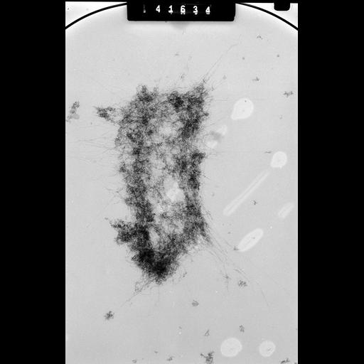  NCBI Organism:Mus musculus; Cell Types:fibroblast Cell Components:nuclear chromosome Biological process:chromosome organization, mitosis, mitotic metaphase;