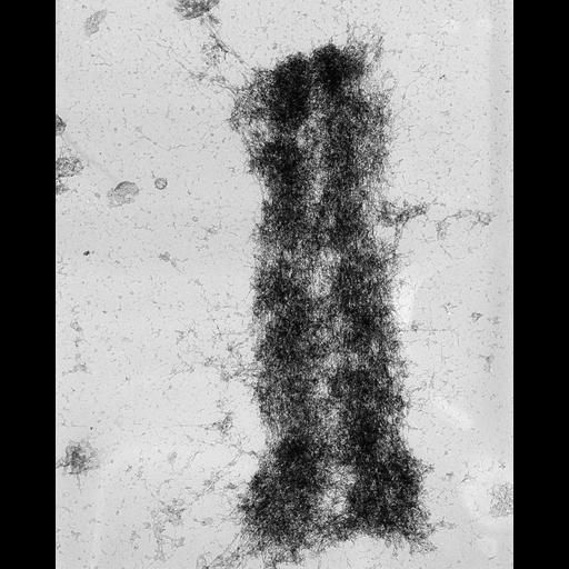  NCBI Organism:Mus musculus; Cell Types:fibroblast Cell Components:nuclear chromosome Biological process:chromosome organization, mitosis, mitotic metaphase;