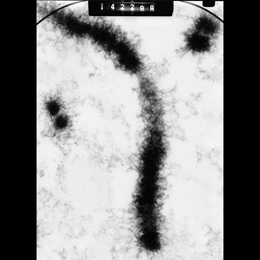  NCBI Organism:Cricetulus griseus; Cell Types:epithelial cell Cell Components:nuclear chromosome Biological process:chromosome organization, mitosis, mitotic metaphase;