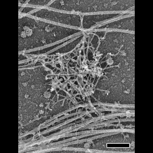  NCBI Organism:Rattus; Cell Components:axon, dendrite, dendritic spine, actin cytoskeleton, microtubule cytoskeleton; Biological process:dendrite morphogenesis