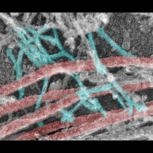  NCBI Organism:Rattus; Cell Components:axon, dendrite, dendritic spine, actin cytoskeleton, microtubule cytoskeleton; Biological process:dendrite morphogenesis