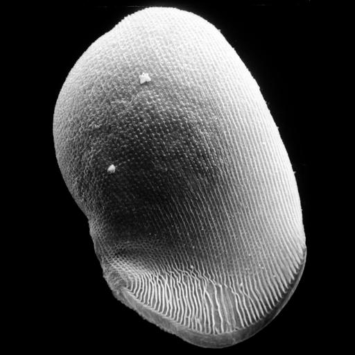  NCBI Organism:uncultured scuticociliate, , ; Cell Types:cell by organism, eukaryotic cell, , ; Cell Components:cilium, , coated pit; Biological process:cortical cytoskeleton organization