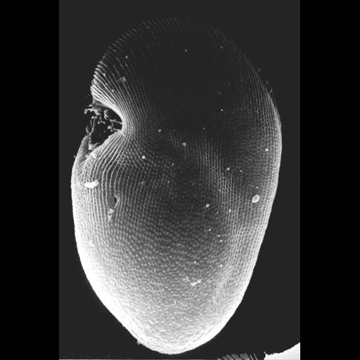  NCBI Organism:uncultured scuticociliate, , ; Cell Types:cell by organism, eukaryotic cell, , ; Cell Components:cilium, , coated pit; Biological process:cortical cytoskeleton organization