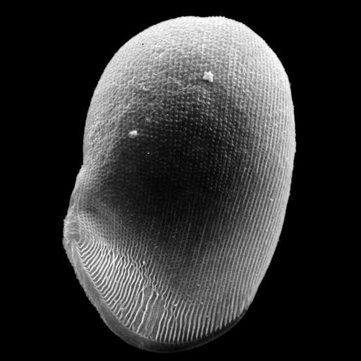  NCBI Organism:uncultured scuticociliate, , ; Cell Types:cell by organism, eukaryotic cell, , ; Cell Components:cilium, , coated pit; Biological process:cortical cytoskeleton organization