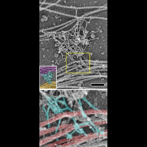  NCBI Organism:Rattus; Cell Components:axon, dendrite, dendritic spine, actin cytoskeleton, microtubule cytoskeleton; Biological process:dendrite morphogenesis