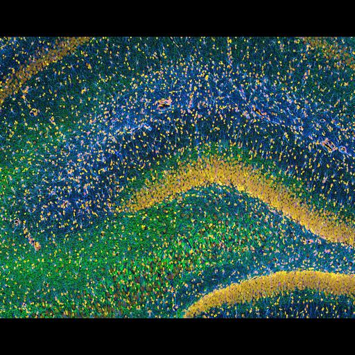  NCBI Organism:Rattus; Cell Types:glial cell, neuron; Cell Components:neurofilament cytoskeleton, nucleus; Biological process:hippocampus development