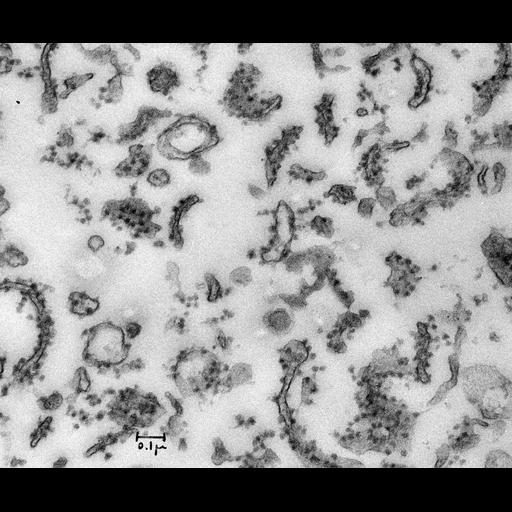  NCBI Organism:Rattus rattus; Cell Types:hepatocyte Cell Components:microsome, ribosome, rough microsome, rough endoplasmic reticulum;