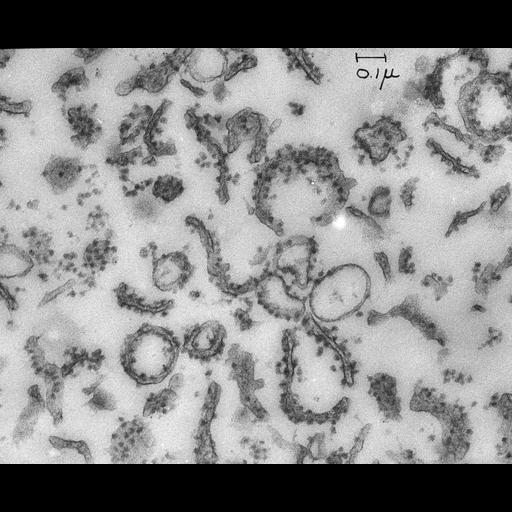  NCBI Organism:Rattus rattus; Cell Types:hepatocyte Cell Components:microsome, ribosome, rough microsome, rough endoplasmic reticulum;