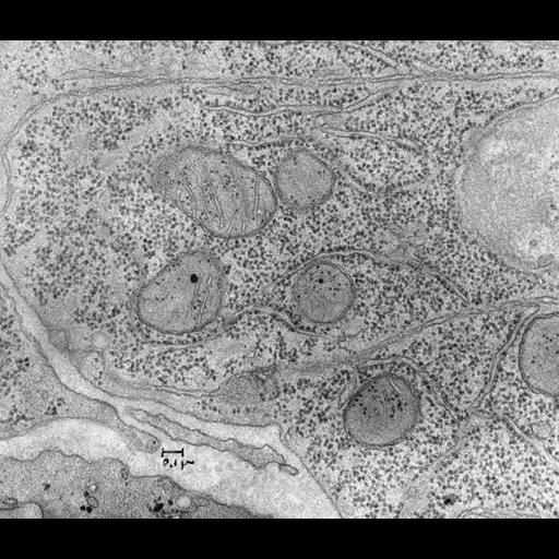  NCBI Organism:Mus musculus; Cell Components:rough endoplasmic reticulum, , nucleus, mitochondrion, plasma membrane; Biological process:, cytoplasm organization;