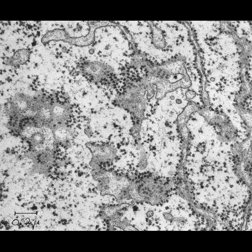  NCBI Organism:Rattus rattus; Cell Types:hepatocyte Cell Components:rough endoplasmic reticulum, polysome; Biological process:, cytoplasm organization, endoplasmic reticulum organization;