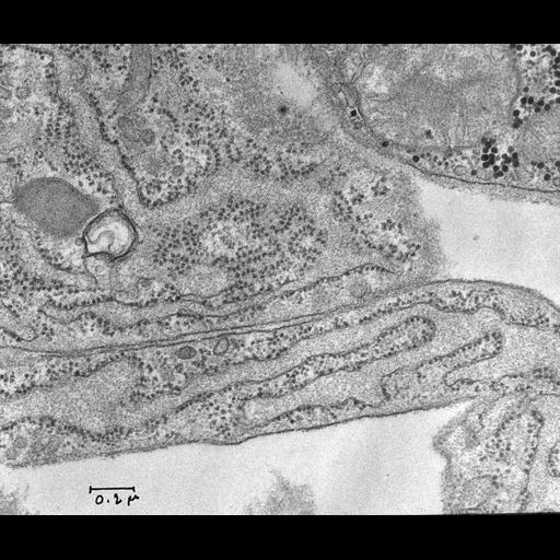  NCBI Organism:Rattus rattus; Cell Types:fibroblast Cell Components:rough endoplasmic reticulum, polysome, endoplasmic reticulum cisternal network; Biological process:, cytoplasm organization, endoplasmic reticulum organization;