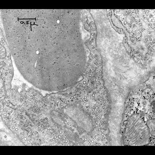  NCBI Organism:Rattus rattus; Cell Types:reticulocyte Cell Components:polysome, ; Biological process:, cytoplasm organization;