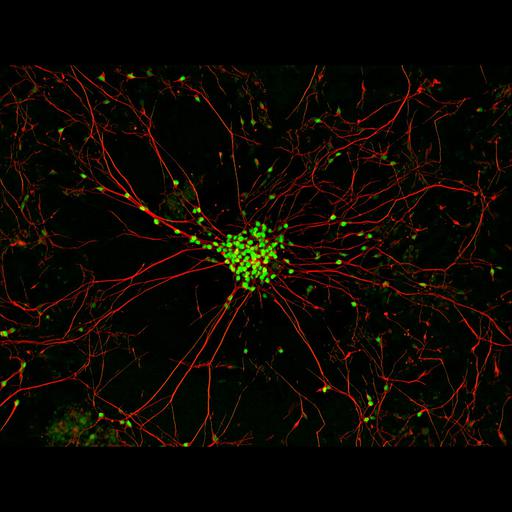  NCBI Organism:Homo sapiens; Cell Types:motor neuron, stem cell; Cell Components:neuron projection, cell body; Biological process:stem cell differentiation