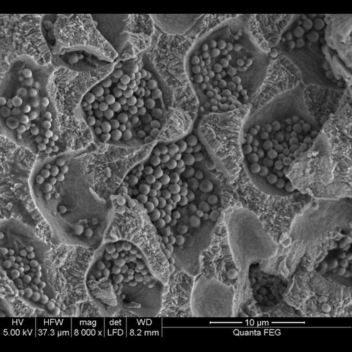  NCBI Organism:Corallinales; Cell Components:cell surface