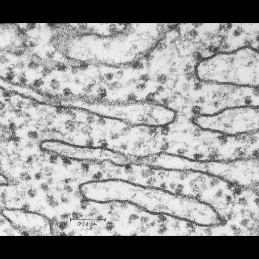  NCBI Organism:Rattus rattus; Cell Components:rough endoplasmic reticulum, ribosome; Biological process:, cytoplasm organization;