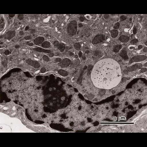  NCBI Organism:Cavia porcellus; Cell Types:Leydig cell Cell Components:nucleus, nuclear chromatin, vacuole, mitochondrion, smooth endoplasmic reticulum; Biological process:organelle organization